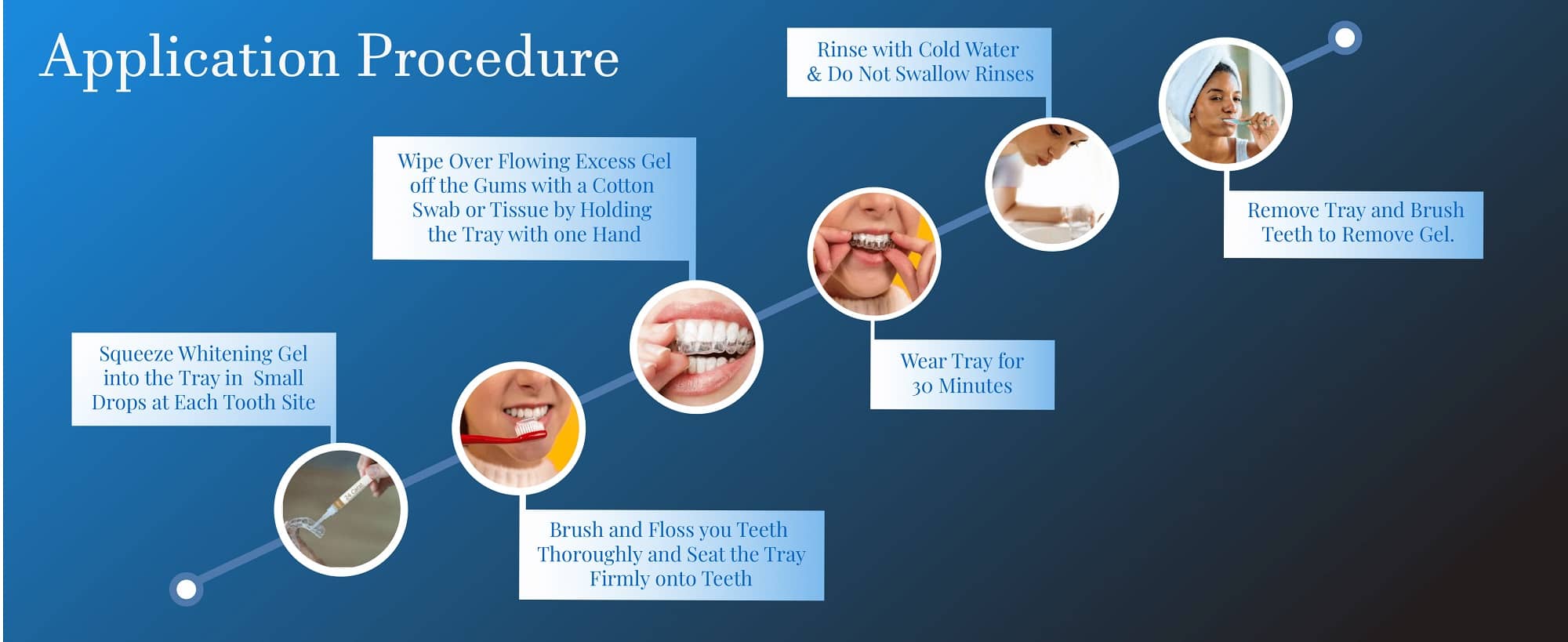 home whitening system