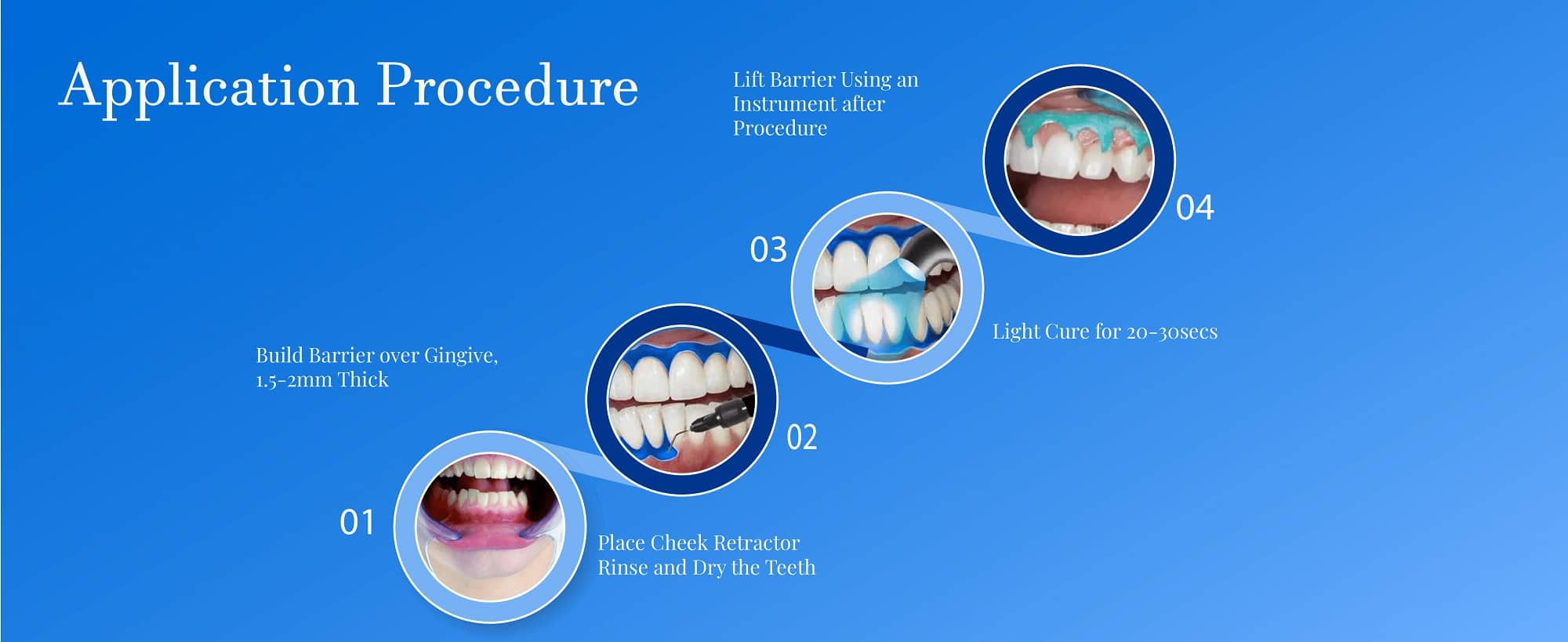gingival barrier