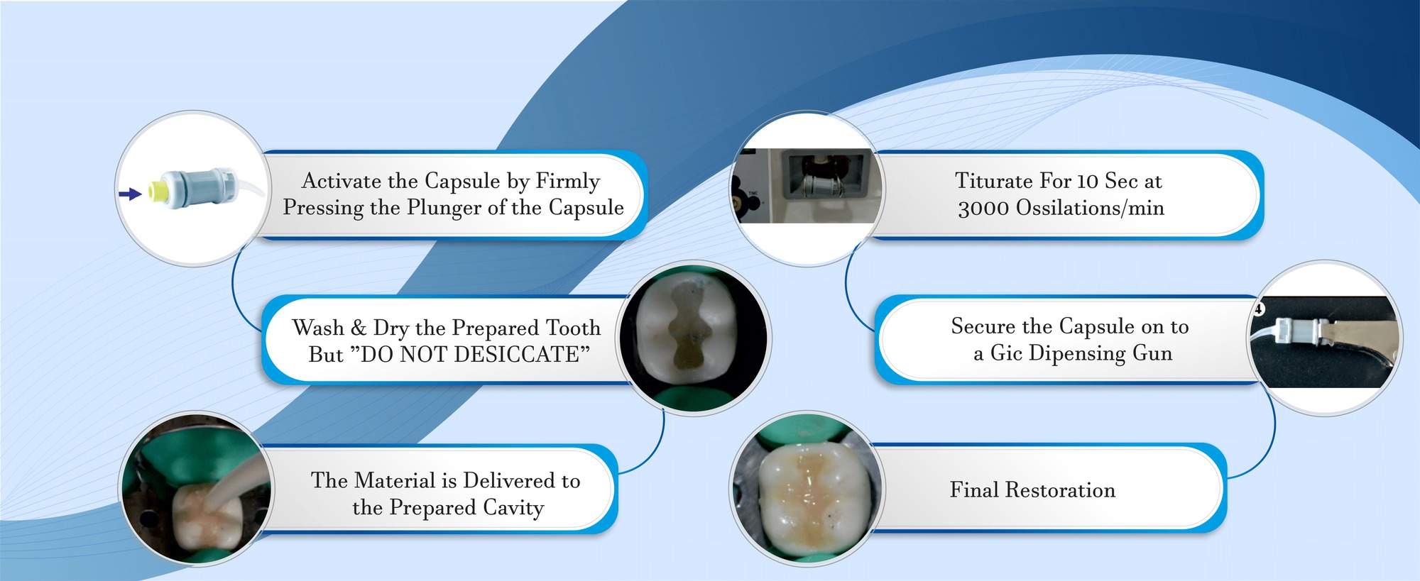 Glass ionomer cement capsule