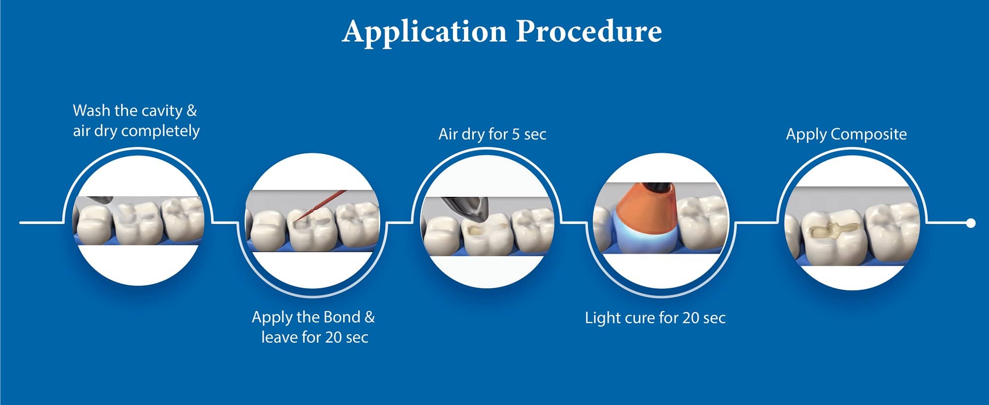 MDP bond adhesive 7th generation