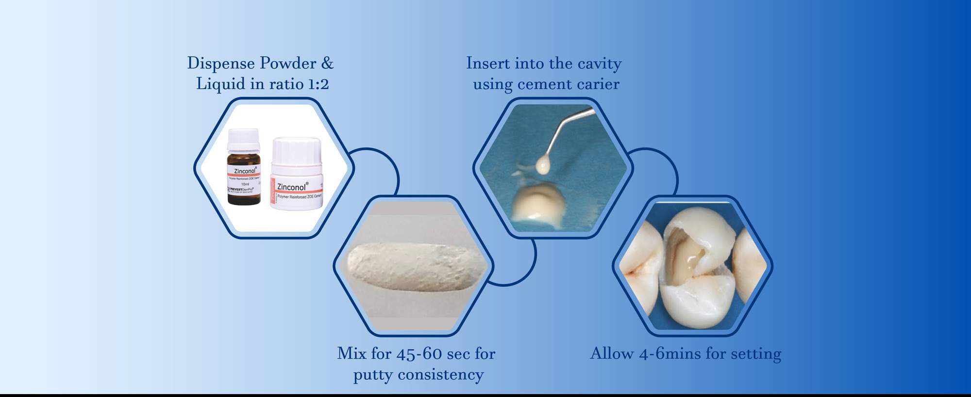polymer reinforced zinc oxide eugenol cement