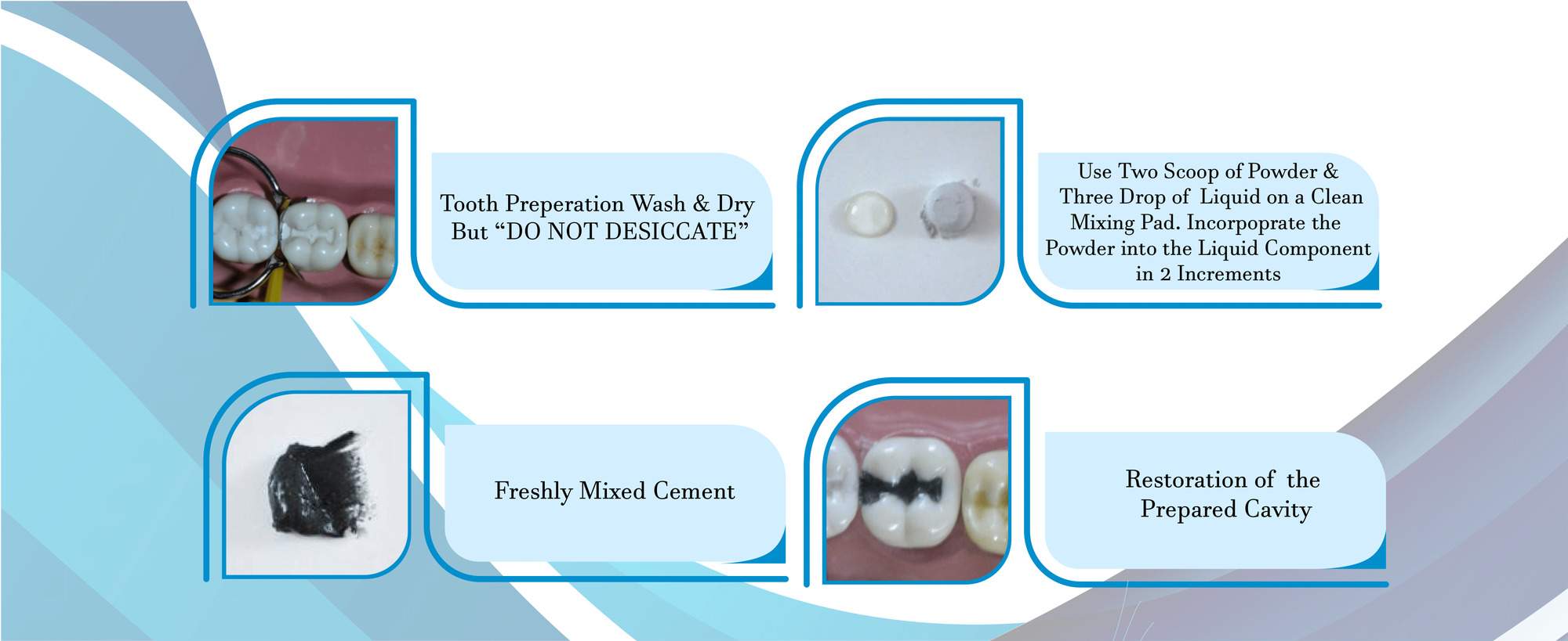 silver reinforced glass ionomer cement