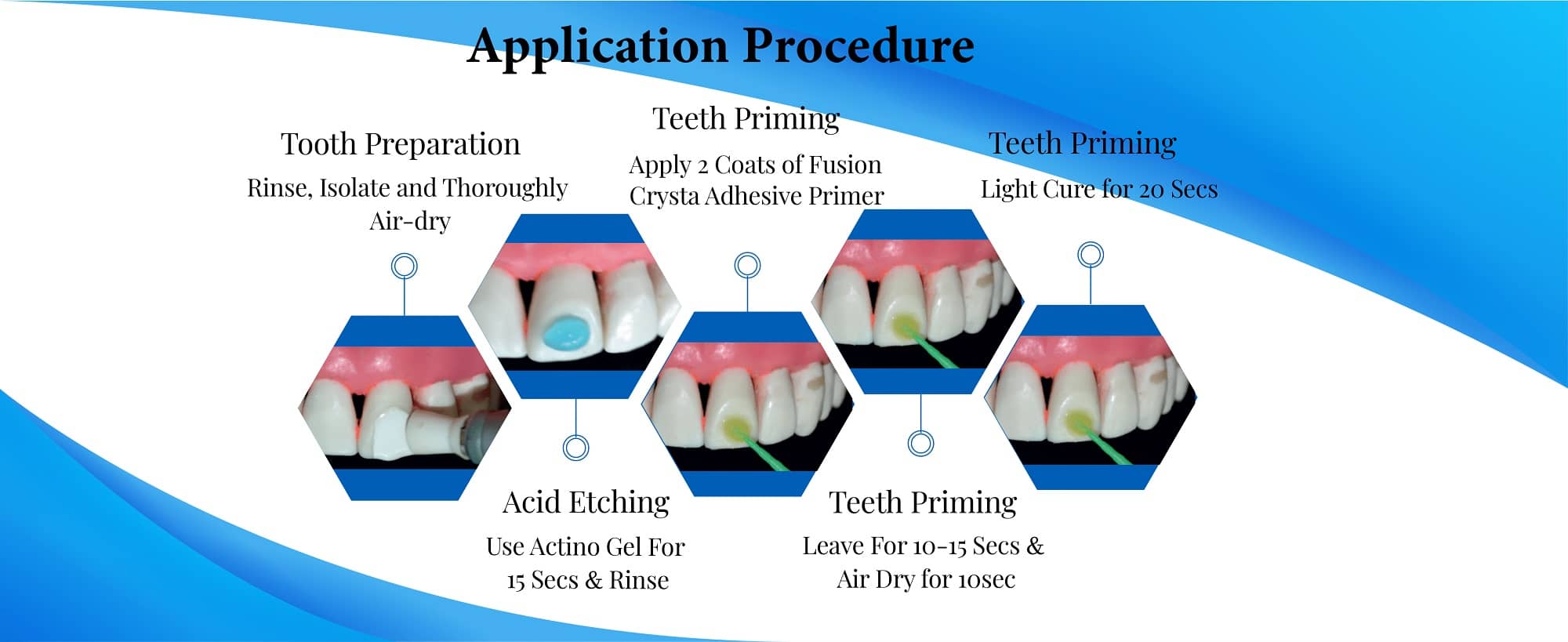 Orthodontic adhesive
