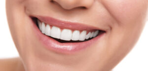 Healthy Smile with Fluoride Varnish