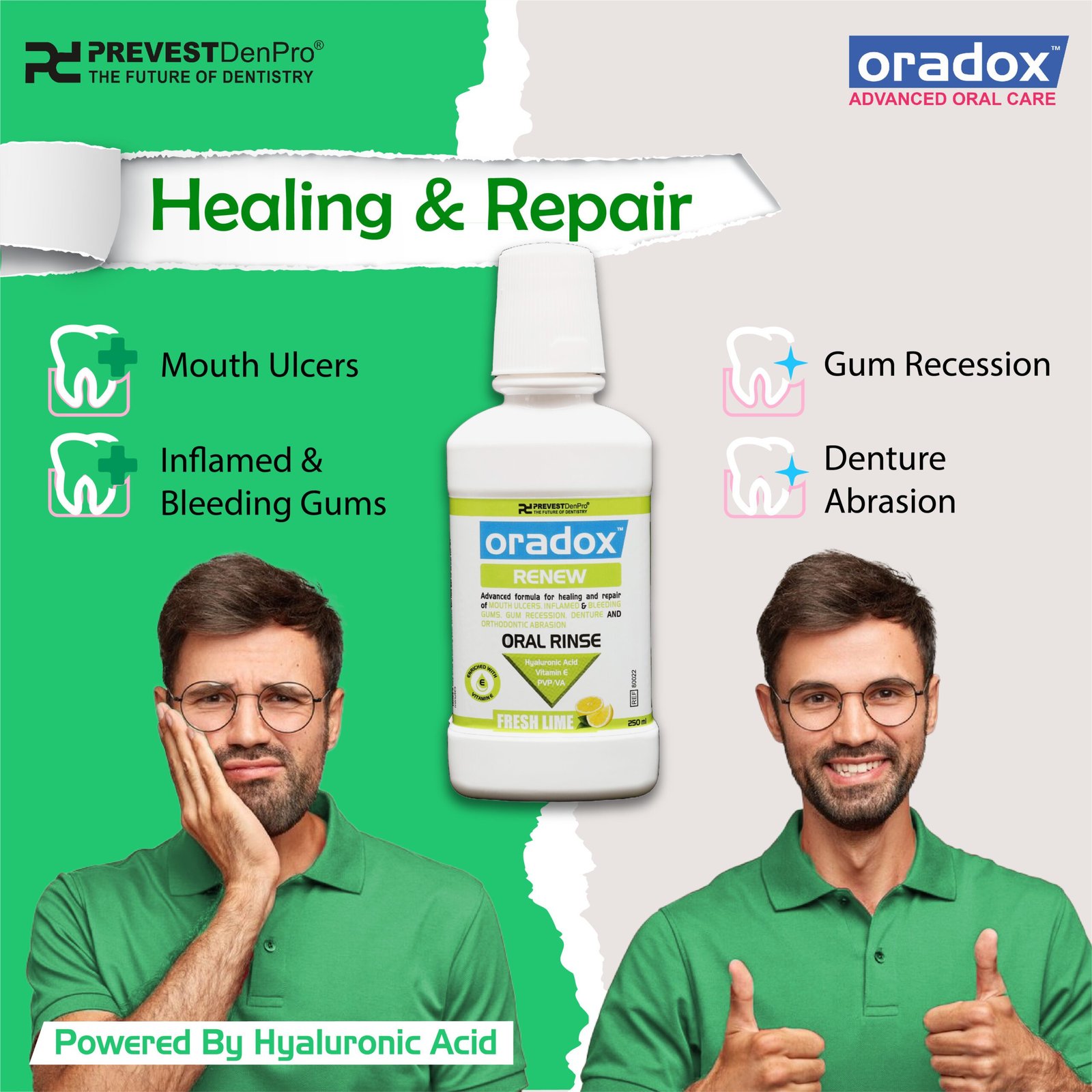 Oradox Oral Rinses - Renew - Image 7